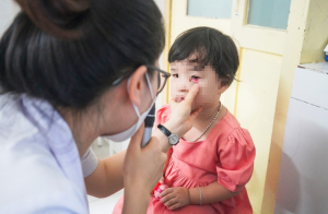 Bộ Y tế: Kiểm soát chặt chẽ giá thuốc điều trị bệnh đau mắt đỏ