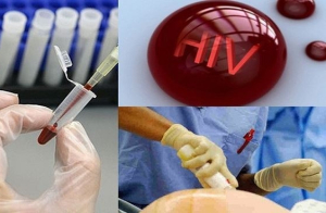 Điều kiện xác định người bị phơi nhiễm HIV, nhiễm HIV do tai nạn rủi ro nghề nghiệp