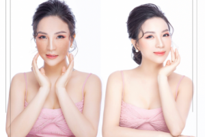 Giải pháp nào cho da nám bị nhiễm Cordicoid 