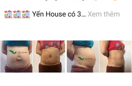 Khách hàng sẽ bị “dần nhừ tử” khi đến giảm mỡ bụng tại Yến house