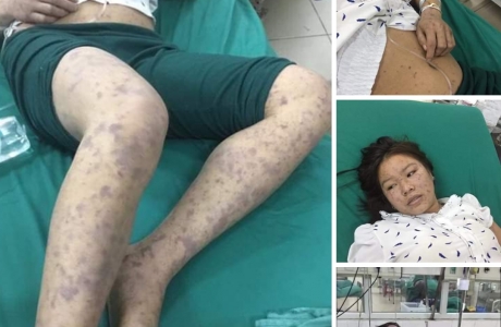 Bộ NN&PTNT đề nghị xử lý việc đưa tin thất thiệt về dịch tả lợn châu Phi